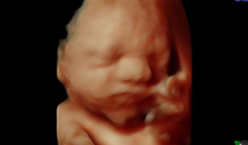29weekultrasound